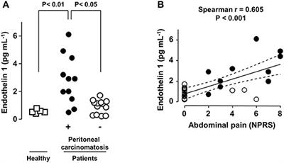 Endothelin-1 Exhibiting Pro-Nociceptive and Pro-Peristaltic Activities Is Increased in Peritoneal Carcinomatosis